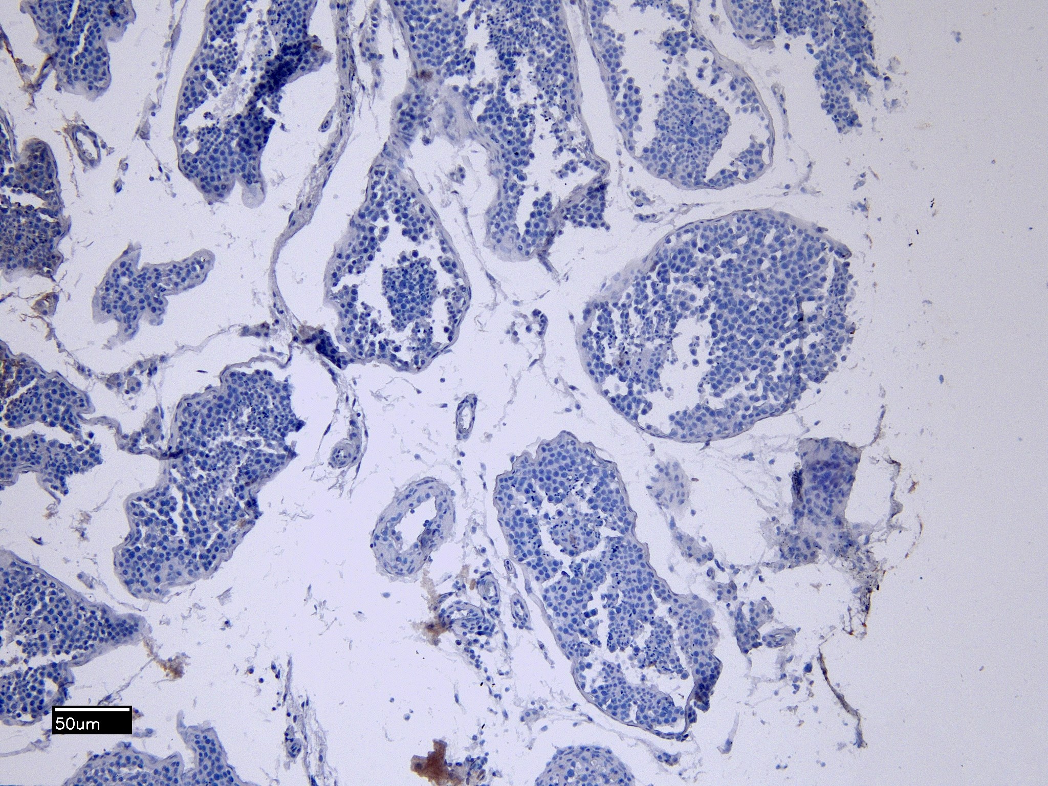 IHC - Goat anti-ACE2 (N Terminal) Antibody AF4549a